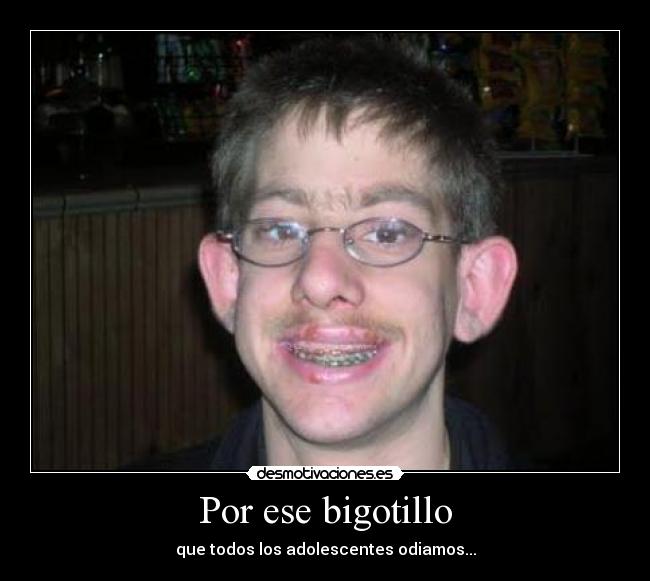 Por ese bigotillo - que todos los adolescentes odiamos...