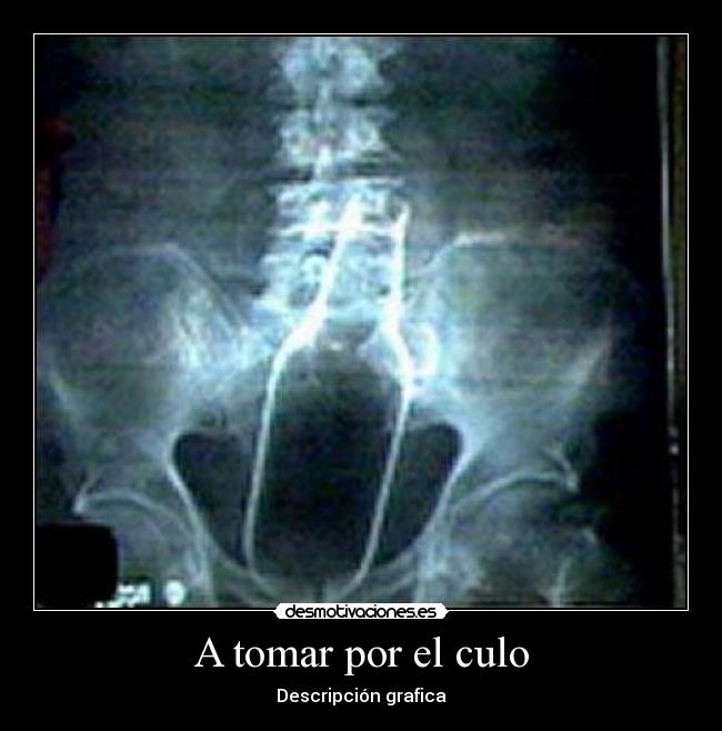 A tomar por el culo - Descripción grafica