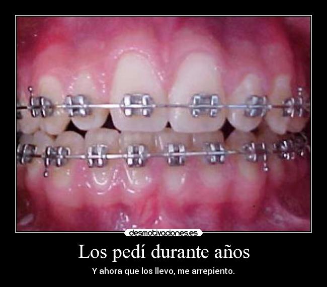 Los pedí durante años - 