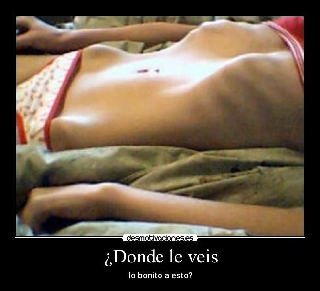 ¿Donde le veis -