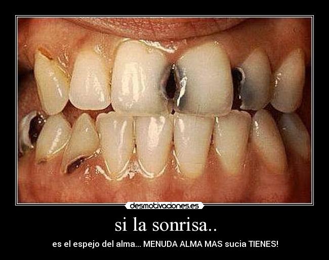 si la sonrisa.. - es el espejo del alma... MENUDA ALMA MAS sucia TIENES!