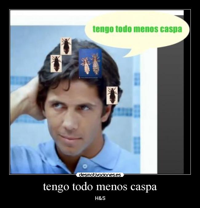 tengo todo menos caspa -