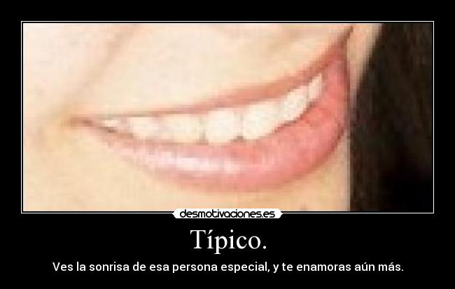 Típico. -