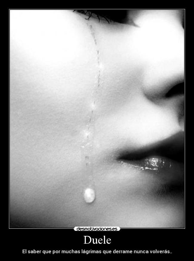 Duele -