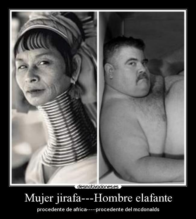 Mujer jirafa---Hombre elafante - 