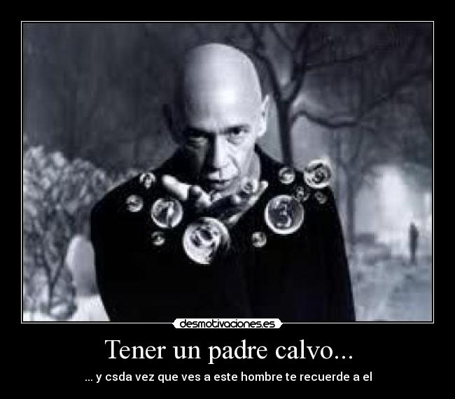 Tener un padre calvo... - 