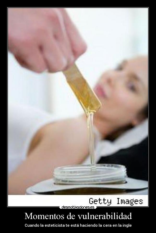 Momentos de vulnerabilidad - Cuando la esteticista te está haciendo la cera en la ingle