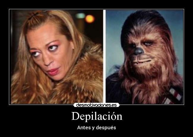Depilación - Antes y después