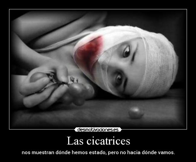 carteles cicatrices suicidio intento deprimido desamor sin esperanza mero desesperacion tristeza carino fam desmotivaciones