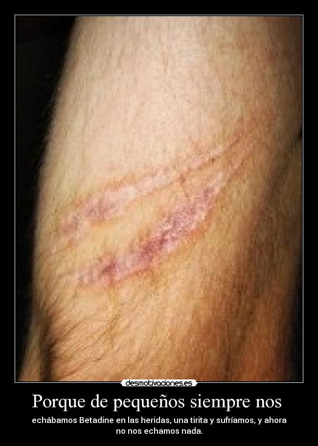 Porque de pequeños siempre nos -