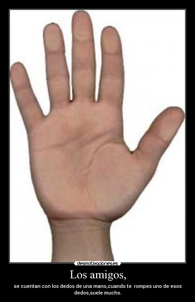 Los amigos, - se cuentan con los dedos de una mano,cuando te rompes uno de esos
dedos,suele mucho.