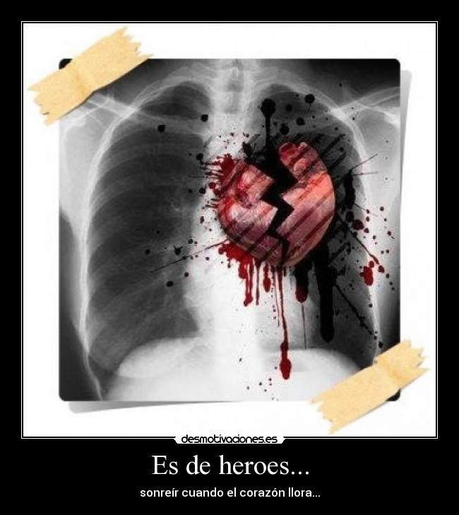 Es de heroes... - sonreír cuando el corazón llora...