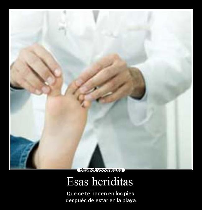 Esas heriditas -