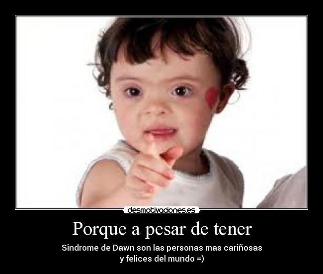 Porque a pesar de tener - 