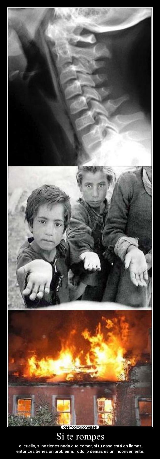 Si te rompes - el cuello, si no tienes nada que comer, si tu casa está en llamas,
entonces tienes un problema. Todo lo demás es un inconveniente.