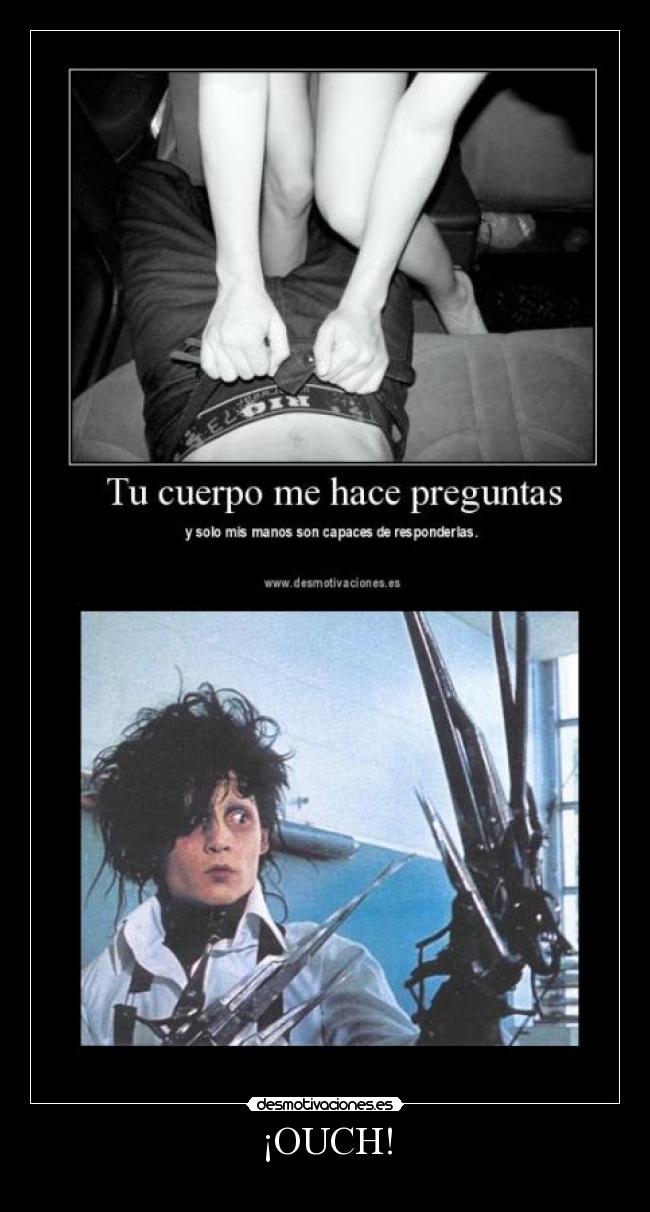 ¡OUCH! - 