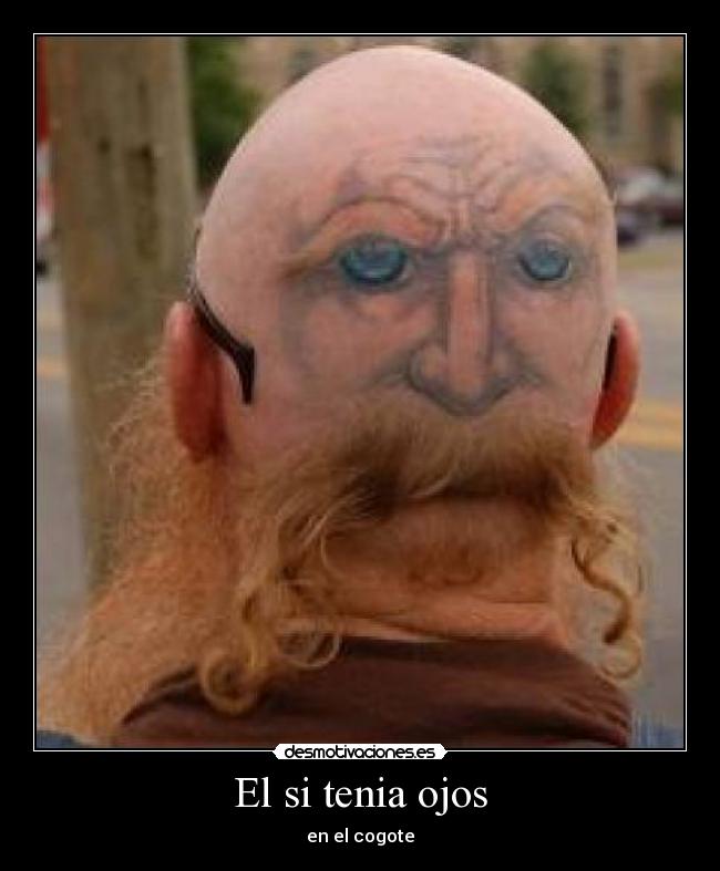 El si tenia ojos - en el cogote