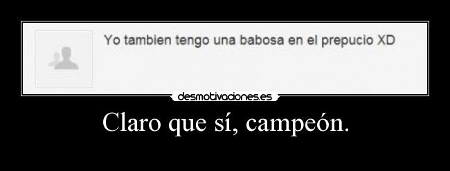 Claro que sí, campeón. -