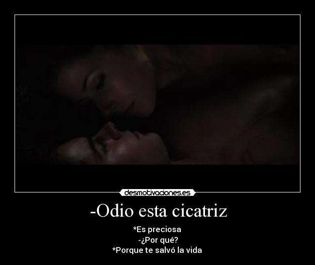 -Odio esta cicatriz - *Es preciosa
-¿Por qué?
*Porque te salvó la vida