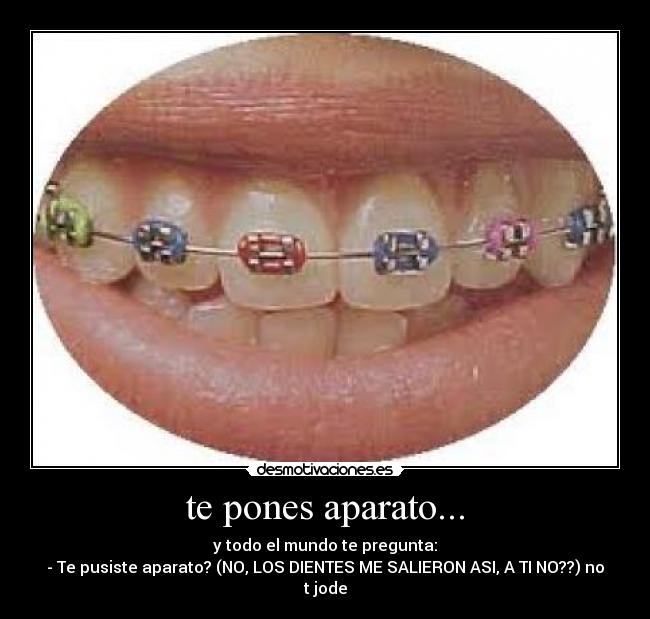 te pones aparato... - 