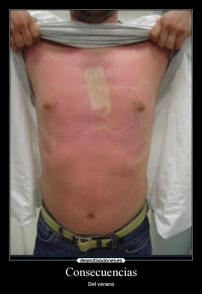 Consecuencias - Del verano