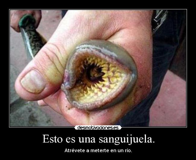 Esto es una sanguijuela. -