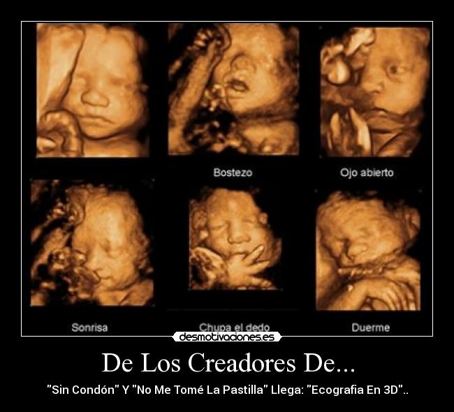 De Los Creadores De... - Sin Condón Y No Me Tomé La Pastilla Llega: Ecografia En 3D..