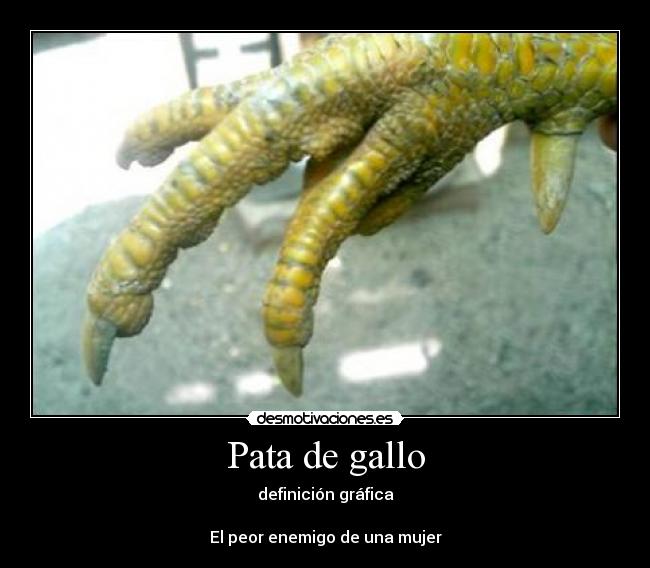 Pata de gallo - definición gráfica
El peor enemigo de una mujer