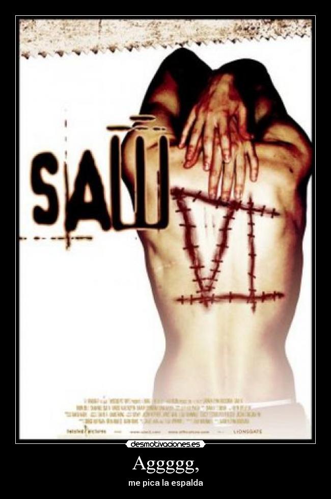 Aggggg, - me pica la espalda