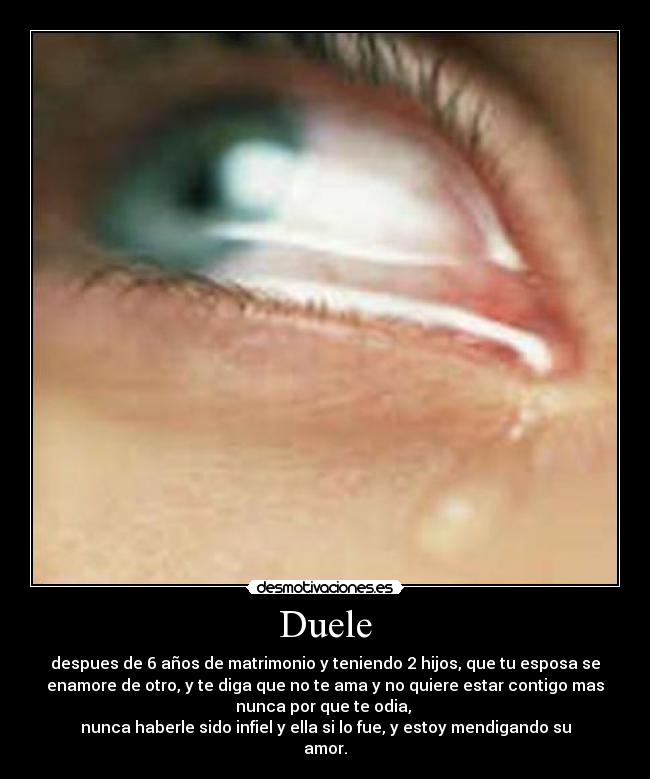 Duele - 
