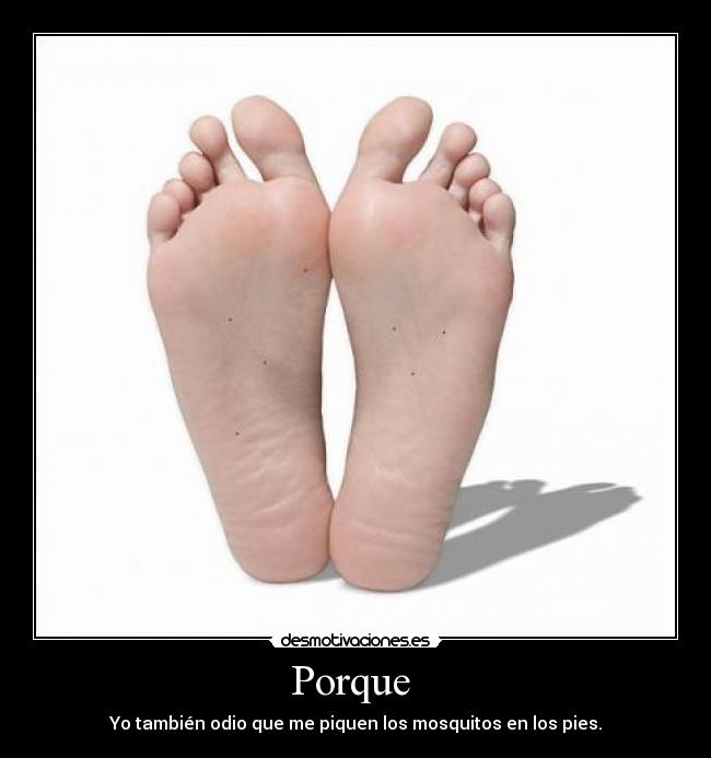 Porque - Yo también odio que me piquen los mosquitos en los pies.