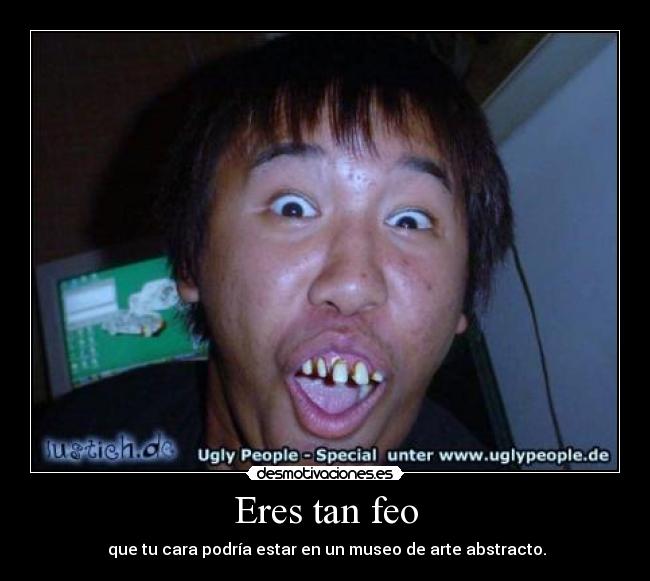 Eres tan feo -