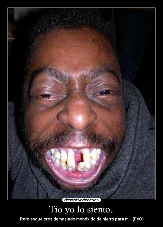 Tio yo lo siento.. -