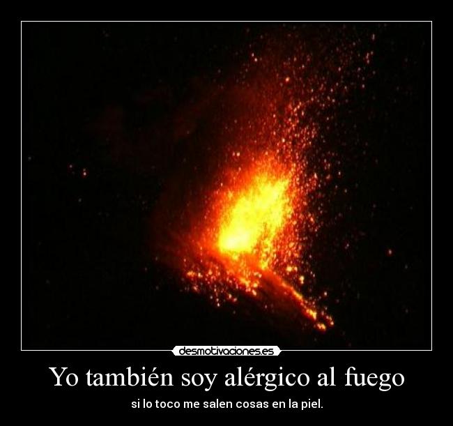 Yo también soy alérgico al fuego -