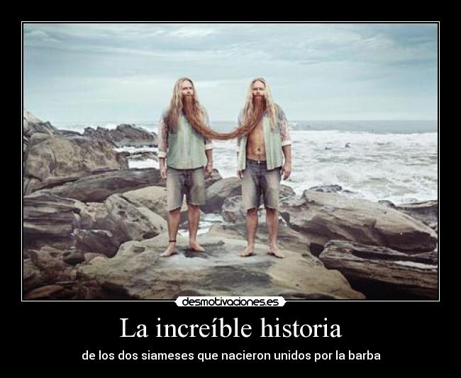 La increíble historia - de los dos siameses que nacieron unidos por la barba