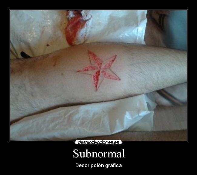 Subnormal -