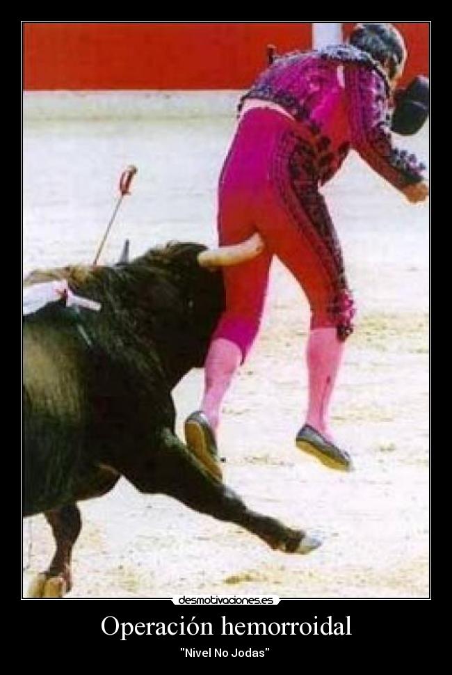 Operación hemorroidal - Nivel No Jodas 