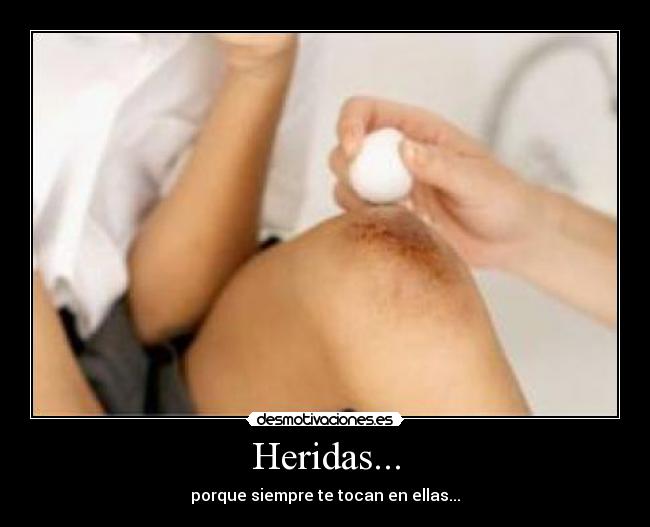 Heridas... - porque siempre te tocan en ellas...