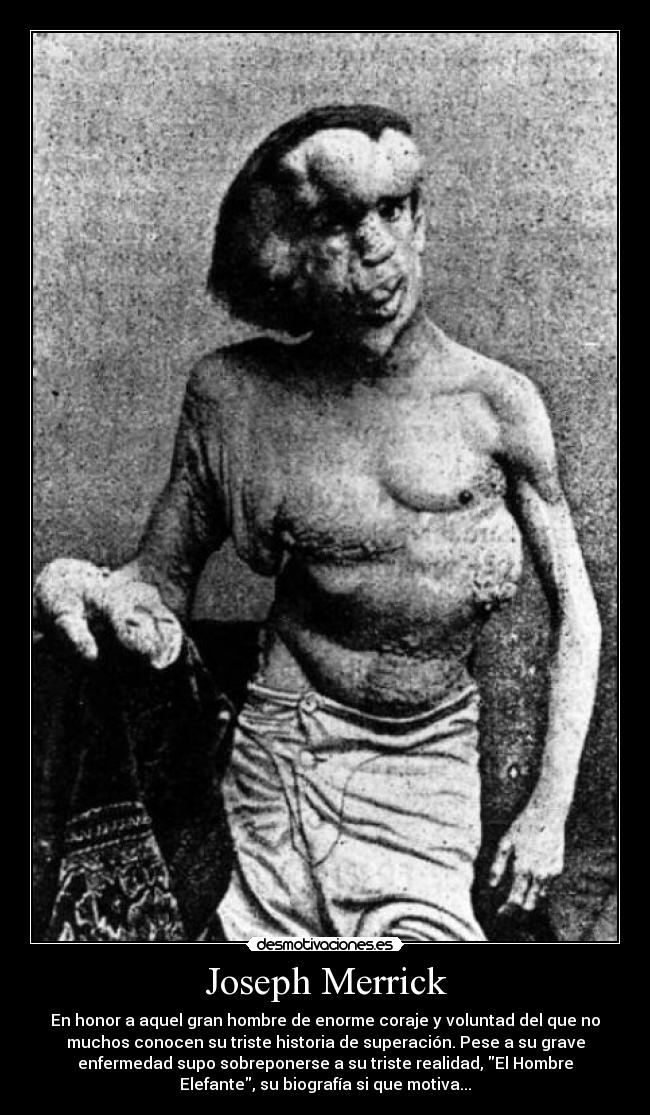 Joseph Merrick - En honor a aquel gran hombre de enorme coraje y voluntad del que no
muchos conocen su triste historia de superación. Pese a su grave
enfermedad supo sobreponerse a su triste realidad, El Hombre
Elefante, su biografía si que motiva...