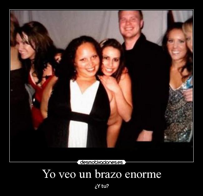 Yo veo un brazo enorme - ¿Y tu?