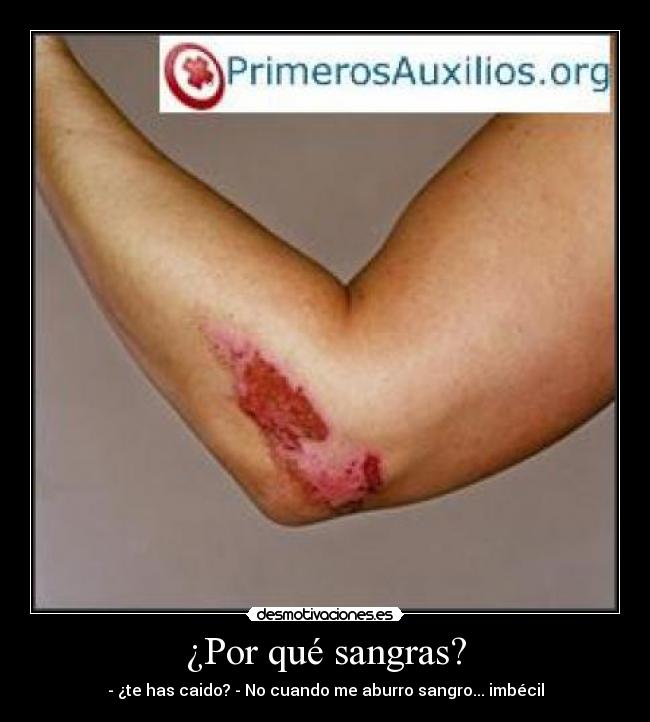 ¿Por qué sangras? - 