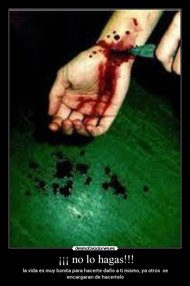 ¡¡¡ no lo hagas!!! -