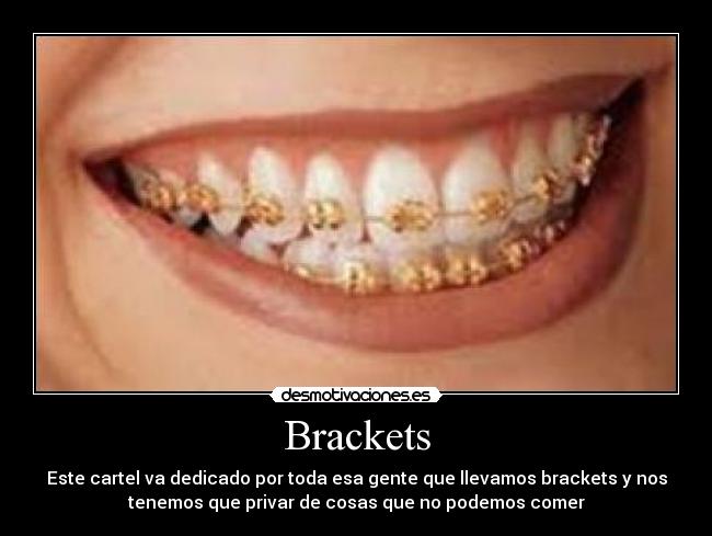Brackets - 