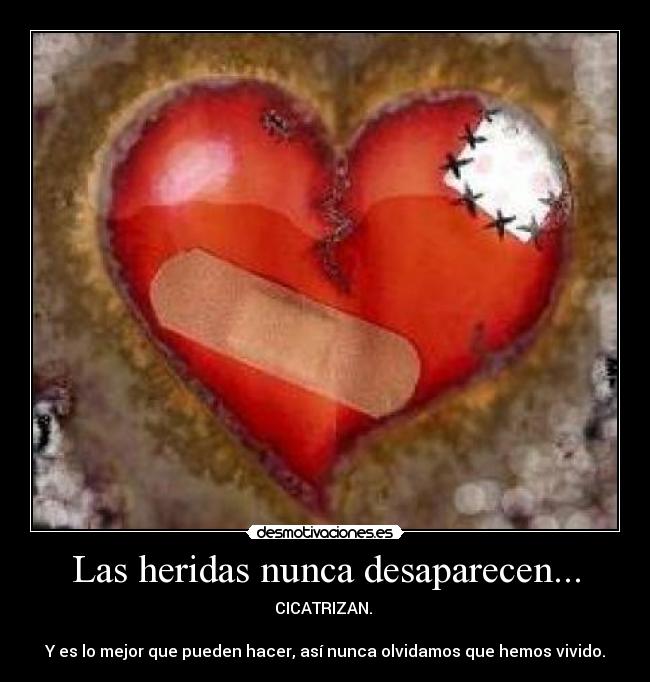Las heridas nunca desaparecen... - CICATRIZAN. 

Y es lo mejor que pueden hacer, así nunca olvidamos que hemos vivido.