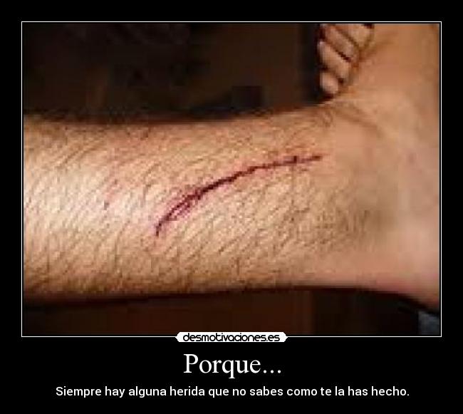 Porque... -
