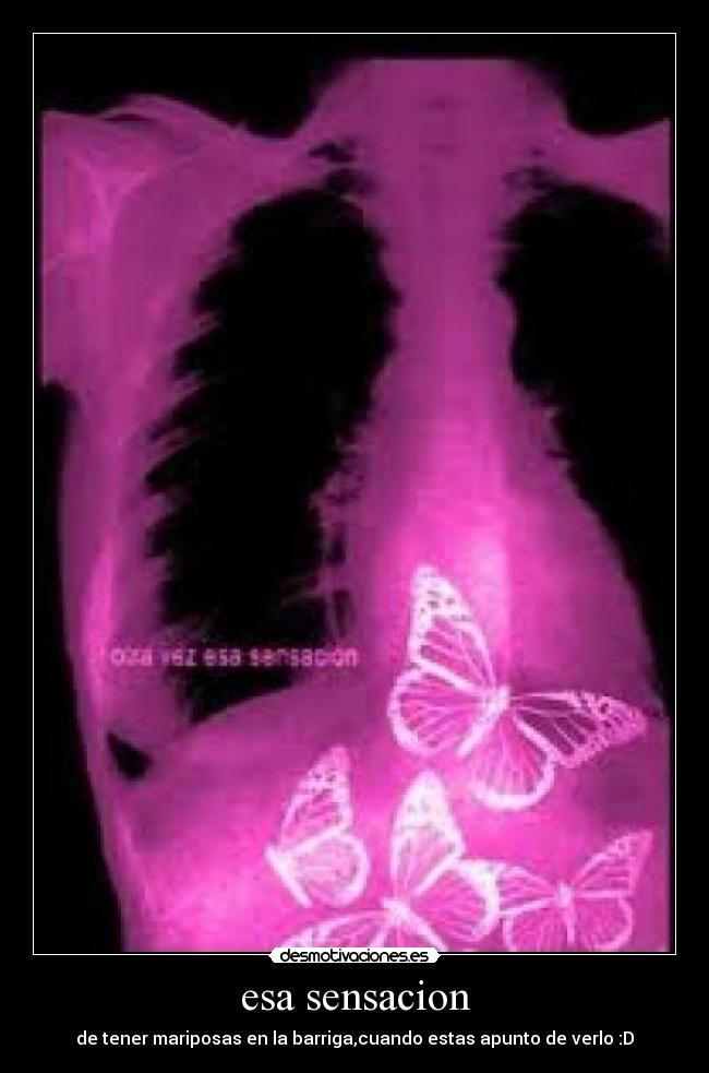 esa sensacion -