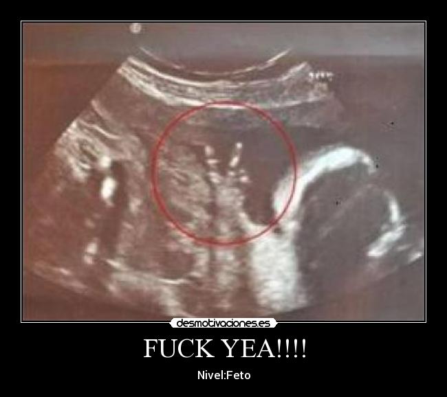 FUCK YEA!!!! - Nivel:Feto