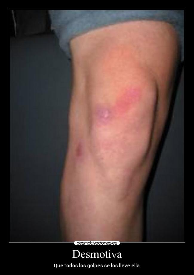 Desmotiva - Que todos los golpes se los lleve ella.