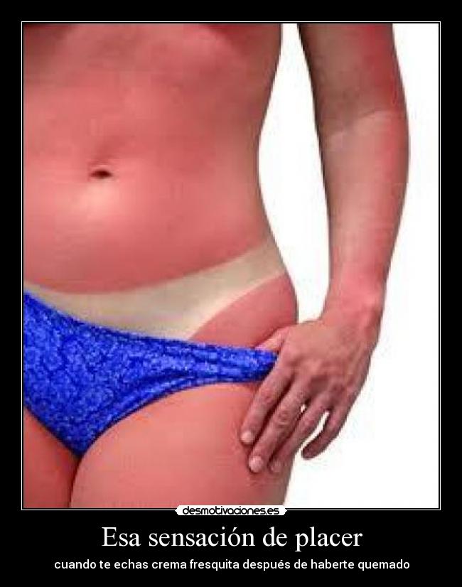 Esa sensación de placer - cuando te echas crema fresquita después de haberte quemado