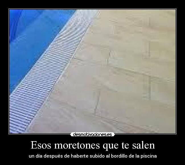 Esos moretones que te salen - 